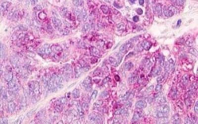 Immunohistochemistry: Motilin R/GPR38 Antibody [NBP3-14407]
